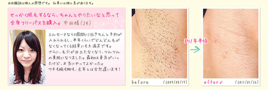 せっかく脱毛するなら、ちゃんとやりたいなと思って全身フリーパスを購入。