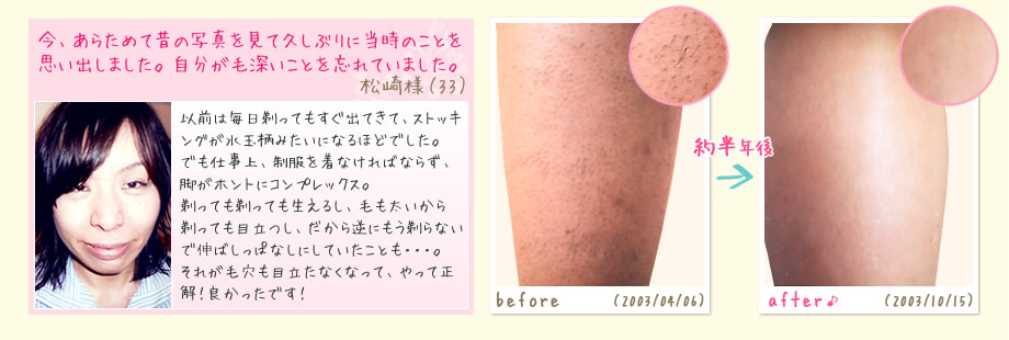 今、あらためて昔の写真を見て久しぶりに当時のことを思い出しました。自分が毛深いことを忘れていました。