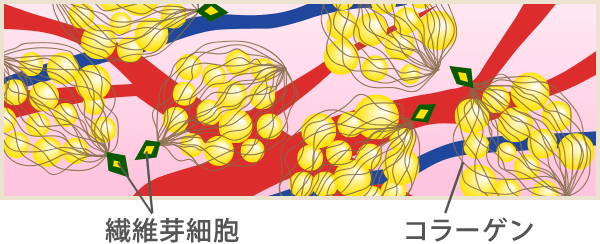 セルライト エステのエルセーヌ