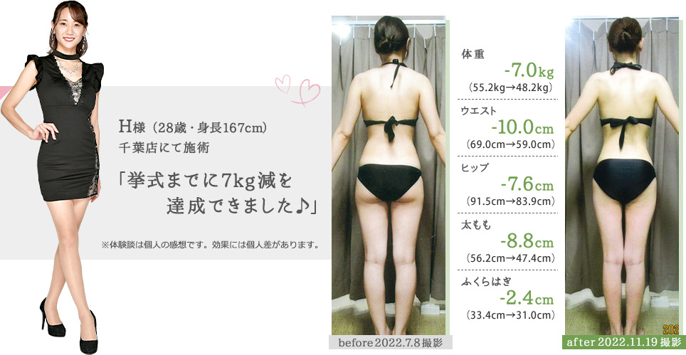 H様（28歳・身長167cm）千葉店にて施術「挙式までに7kg減を達成できました♪」