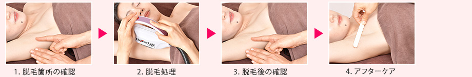 1. 脱毛箇所の確認→2. 脱毛処理→3. 脱毛後の確認→4. アフターケア