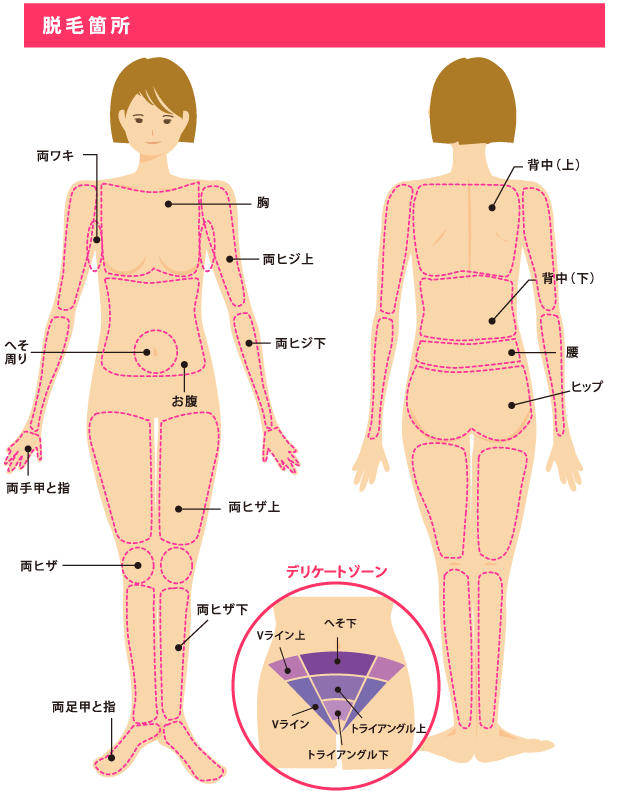 脱毛箇所