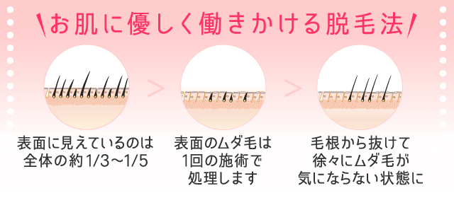 B・S・S(ビューティ・スムース・スキン)脱毛｜エステのエルセーヌ