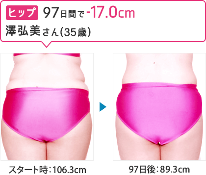 澤弘美さん（35歳）／97日間でヒップ-17.0cm