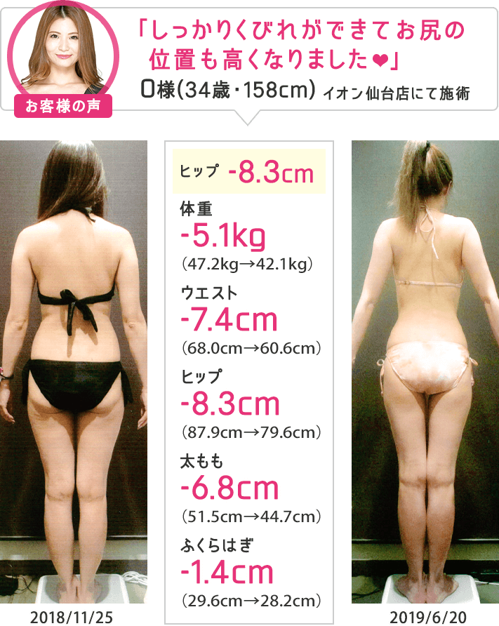 痩身エステなら目指せ！合計-8cmやせる体験｜エステのエルセーヌ