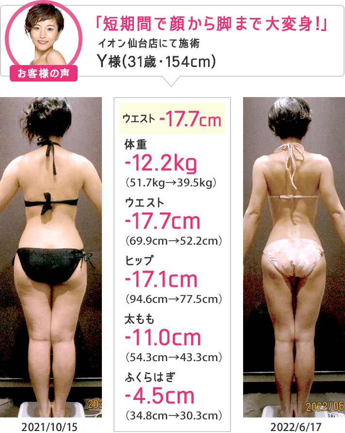 エルセーヌslea⭐︎555ssxプラス　スティック　ダイエット 痩身エステなら目指せ！合計-8cmやせる体験｜エステのエルセーヌ