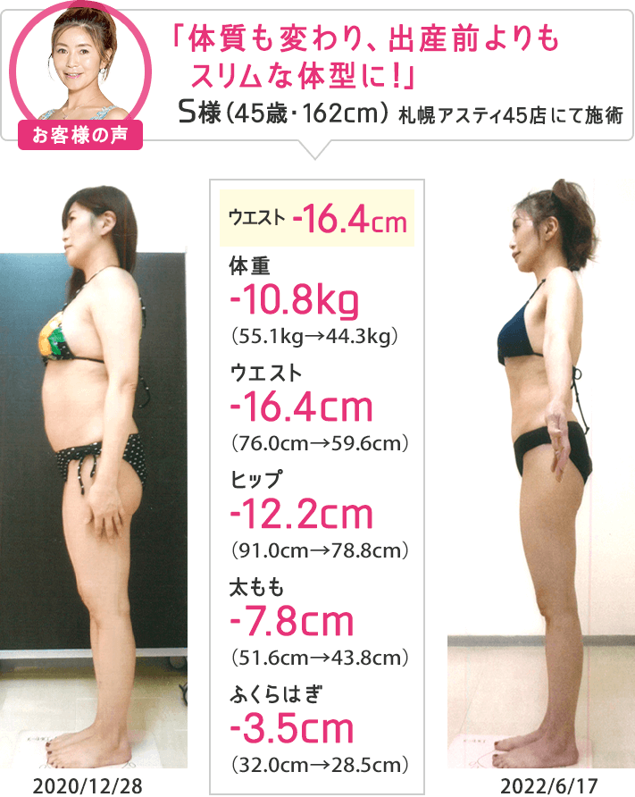 痩身エステなら目指せ！合計-8cmやせる体験｜エステのエルセーヌ