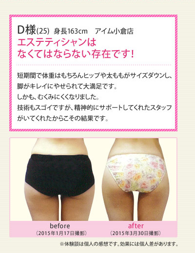 「エステティシャンはなくてはならない存在です!」短期間で体重はもちろんヒップや太ももがサイズダウンし、脚がキレイにやせられて大満足です。しかも、むくみにくくなりました。技術もスゴイですが、精神的にサポートしてくれたスタッフがいてくれたからこその結果です。