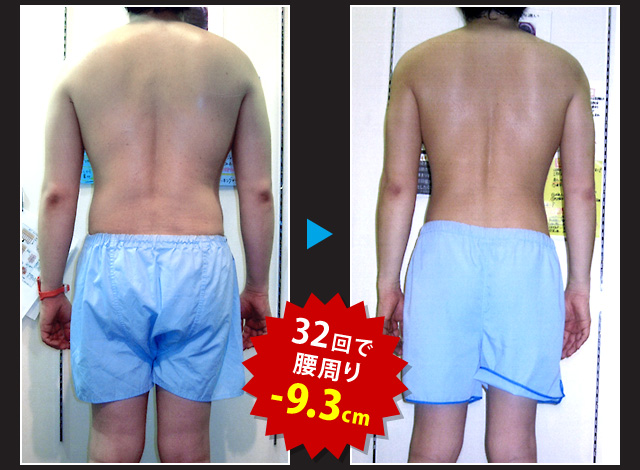 エルセーヌ　ボディジェル2個セット エルセーヌ ボディジェル2個セット （痩身エステなら目指せ