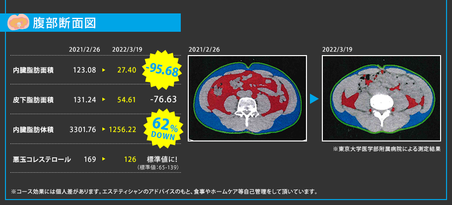 ʢ̿ޡ¡62%DOWN