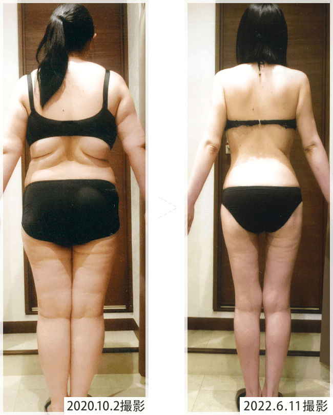 大幅減量コース体験｜エステのエルセーヌ